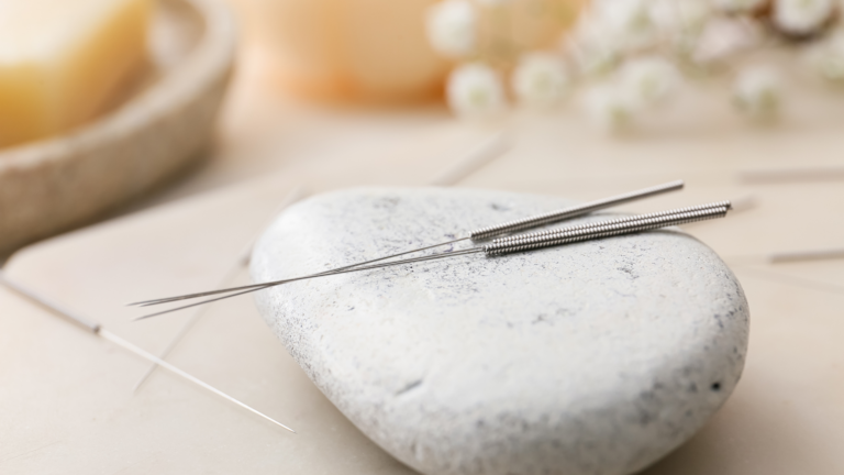 מגלי אשכנזי - רפואה סינית, דיקור סיני - מחטי אפוקונטורה על גבי אבן