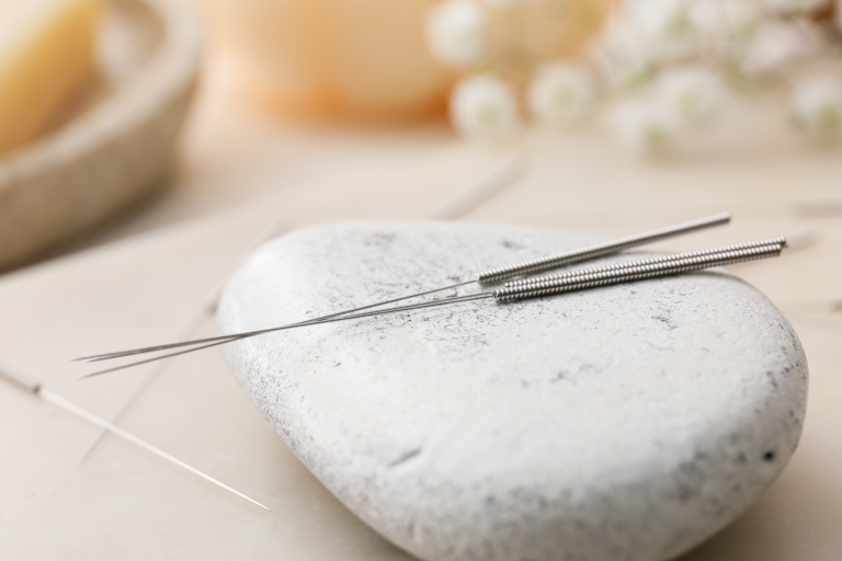 מגלי אשכנזי - רפואה סינית, דיקור סיני - מחטי אפוקונטורה על גבי אבן